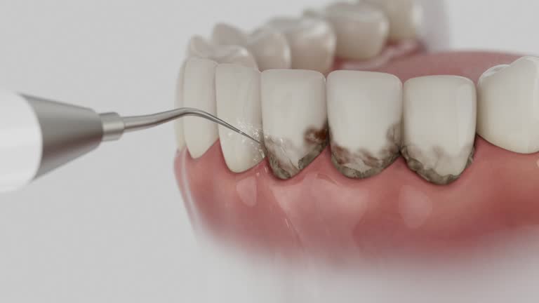 Trusted Tooth Extraction service in Walkersville, MD - Dentist Open Now